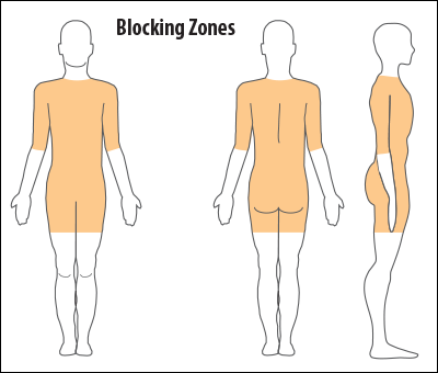 Legal Blocking Zones Diagram